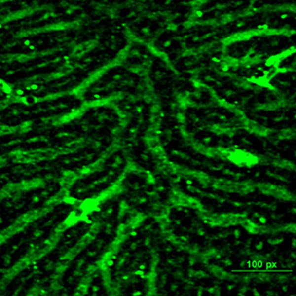 Liver sinusoidal blood vessels as seen using multiphoton microscopy.