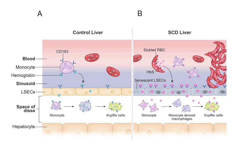 Control Liver and SCD Liver Comparison