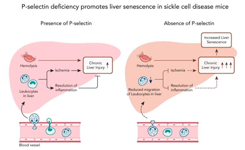 P-selectin Deficiency Illustration
