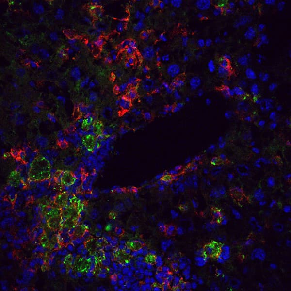 Ferritin (green) and F4/80 (red) in mouse liver section