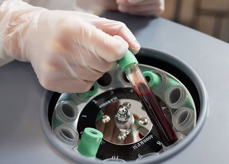 Blood plasma in a centrifuge.