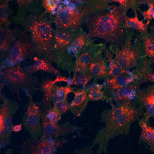 E-cadherin in Hep3B cells.