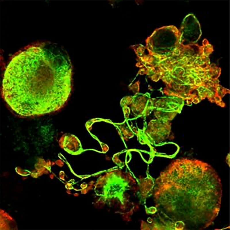 α-tubulin (green) and GPIbα (red) immunofluorescence images of a mouse fetal liver–derived megakaryocyte forming proplatelets in vitro.